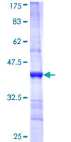 ab157955 on a 12.5% SDS-PAGE stained with Coomassie Blue.