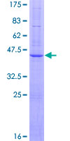 ab164093 on a 12.5% SDS-PAGE stained with Coomassie Blue.