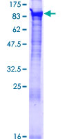 ab163016 on a 12.5% SDS-PAGE stained with Coomassie Blue.
