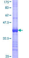 ab163017 on a 12.5% SDS-PAGE stained with Coomassie Blue.
