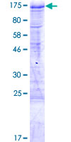 ab163452 on a 12.5% SDS-PAGE stained with Coomassie Blue.
