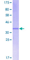 ab161046 on a 12.5% SDS-PAGE stained with Coomassie Blue.