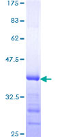 ab160021 on a 12.5% SDS-PAGE stained with Coomassie Blue.