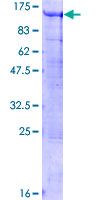 ab162853 on a 12.5% SDS-PAGE stained with Coomassie Blue.