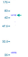 ab157958 on a 12.5% SDS-PAGE stained with Coomassie Blue.