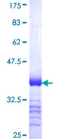 ab166054 on a 12.5% SDS-PAGE stained with Coomassie Blue.