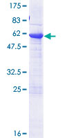 ab160411 on a 12.5% SDS-PAGE stained with Coomassie Blue.