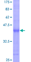ab160410 on a 12.5% SDS-PAGE stained with Coomassie Blue.