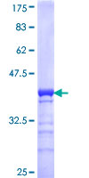 ab166117 on a 12.5% SDS-PAGE stained with Coomassie Blue.