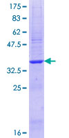 ab162695 on a 12.5% SDS-PAGE stained with Coomassie Blue.