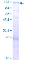 ab153388 on a 12.5% SDS-PAGE stained with Coomassie Blue.