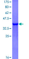 ab153389 on a 12.5% SDS-PAGE stained with Coomassie Blue.
