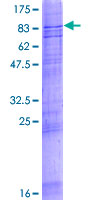 ab152985 on a 12.5% SDS-PAGE stained with Coomassie Blue.