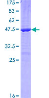 ab152986 on a 12.5% SDS-PAGE stained with Coomassie Blue.