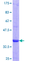 ab152987 on a 12.5% SDS-PAGE stained with Coomassie Blue.