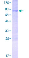 ab166426 on a 12.5% SDS-PAGE stained with Coomassie Blue.