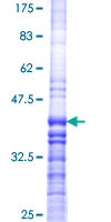ab165512 on a 12.5% SDS-PAGE stained with Coomassie Blue.