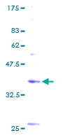 ab160925 on a 12.5% SDS-PAGE stained with Coomassie Blue.