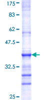 ab160926 on a 12.5% SDS-PAGE stained with Coomassie Blue.