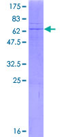 ab160434 on a 12.5% SDS-PAGE stained with Coomassie Blue.