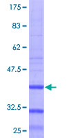 ab160435 on a 12.5% SDS-PAGE stained with Coomassie Blue.