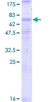 ab157862 on a 12.5% SDS-PAGE stained with Coomassie Blue.