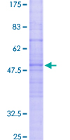 ab158146 on a 12.5% SDS-PAGE stained with Coomassie Blue.