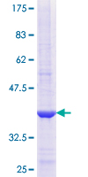 ab160413 on a 12.5% SDS-PAGE stained with Coomassie Blue.