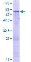ab164310 on a 12.5% SDS-PAGE stained with Coomassie Blue.