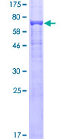 ab153076 on a 12.5% SDS-PAGE stained with Coomassie Blue.
