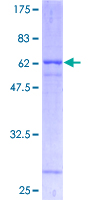ab157926 on a 12.5% SDS-PAGE stained with Coomassie Blue.