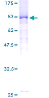 ab161589 on a 12.5% SDS-PAGE stained with Coomassie Blue.