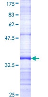 ab162492 on a 12.5% SDS-PAGE stained with Coomassie Blue.