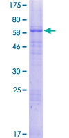 ab163783 on a 12.5% SDS-PAGE stained with Coomassie Blue.