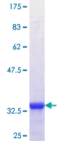 ab163784 on a 12.5% SDS-PAGE stained with Coomassie Blue.