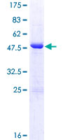 ab163273 on a 12.5% SDS-PAGE stained with Coomassie Blue.