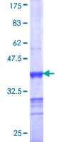 ab163274 on a 12.5% SDS-PAGE stained with Coomassie Blue.