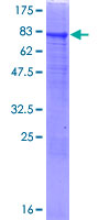 ab153518 on a 12.5% SDS-PAGE stained with Coomassie Blue.