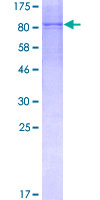 ab157962 on a 12.5% SDS-PAGE stained with Coomassie Blue.