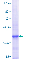 ab158791 on a 12.5% SDS-PAGE stained with Coomassie Blue.