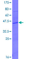 ab159816 on a 12.5% SDS-PAGE stained with Coomassie Blue.