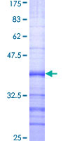 ab163134 on a 12.5% SDS-PAGE stained with Coomassie Blue.