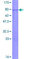 ab157968 on a 12.5% SDS-PAGE stained with Coomassie Blue.