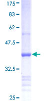 ab157969 on a 12.5% SDS-PAGE stained with Coomassie Blue.