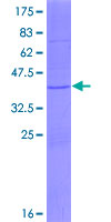 ab153646 on a 12.5% SDS-PAGE stained with Coomassie Blue.