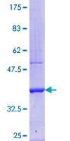 ab153647 on a 12.5% SDS-PAGE stained with Coomassie Blue.