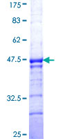 ab157966 on a 12.5% SDS-PAGE stained with Coomassie Blue.