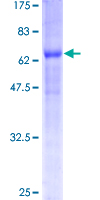ab157972 on a 12.5% SDS-PAGE stained with Coomassie Blue.