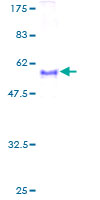 ab157975 on a 12.5% SDS-PAGE stained with Coomassie Blue.