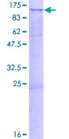 ab153214 on a 12.5% SDS-PAGE stained with Coomassie Blue.